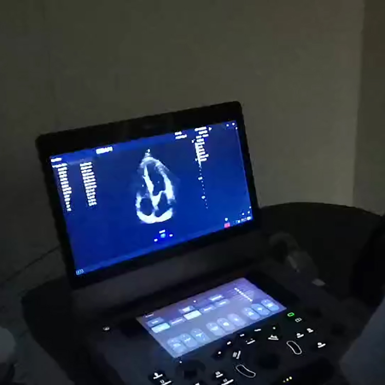 Diseño popular de la máquina de ultrasonido Edan Acclarix AX3 con sonda lineal y convexa