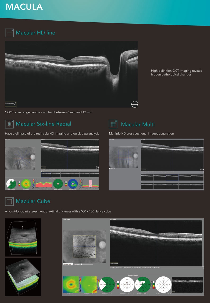 Oct Optometry Options New OCT Ophthalmic OCT Optical Coherence Tomography MSLOCT06