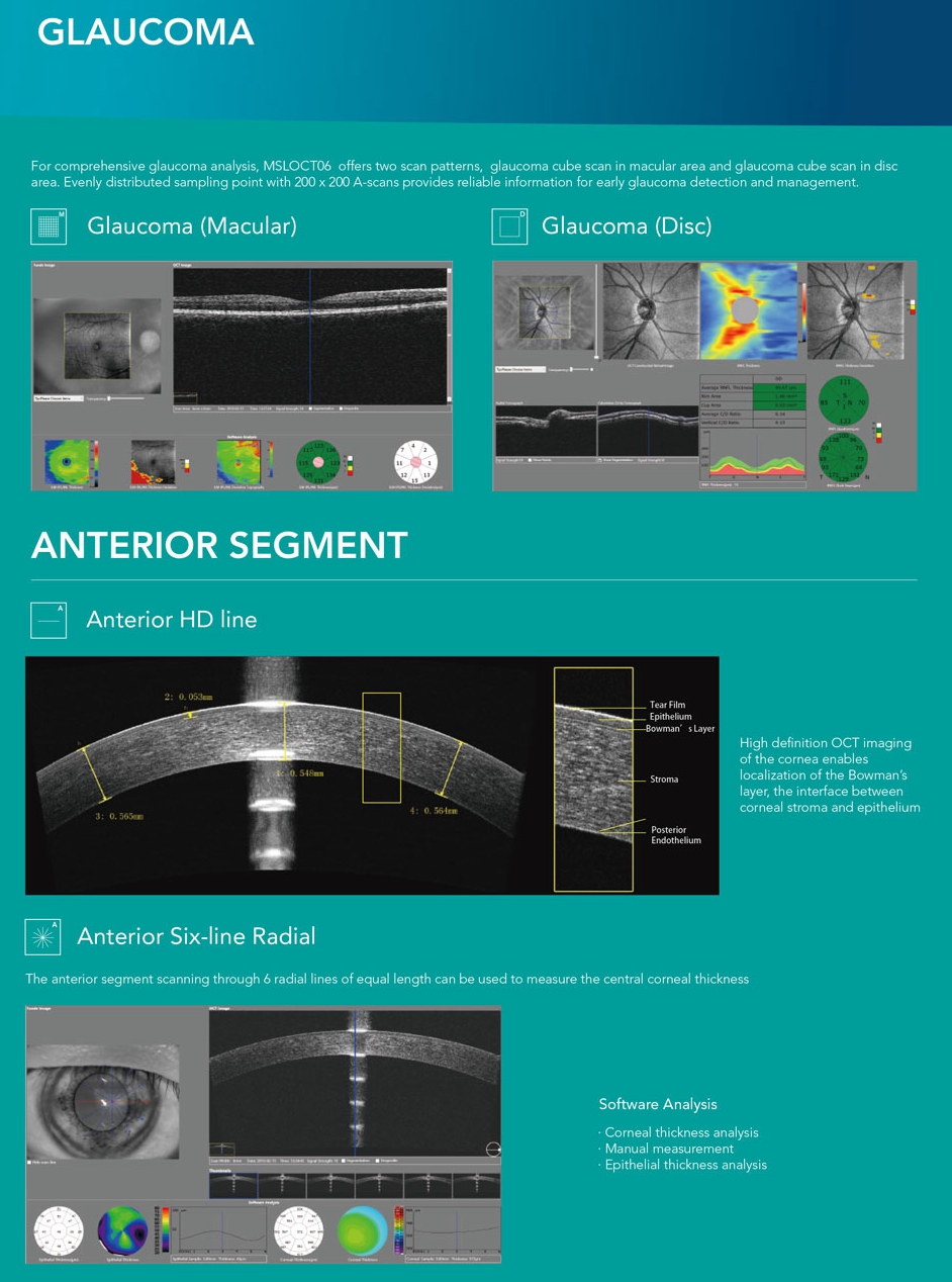 New OCT Ophthalmic OCT Optical Coherence Tomography MSLOCT06