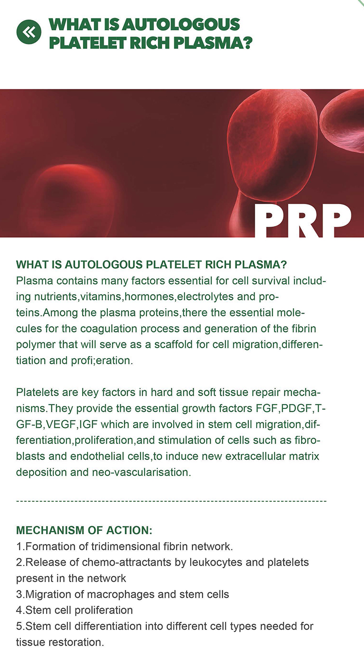 Tubos activadores de PRP de alta calidad para colección de sangre médica de 10 ml en venta